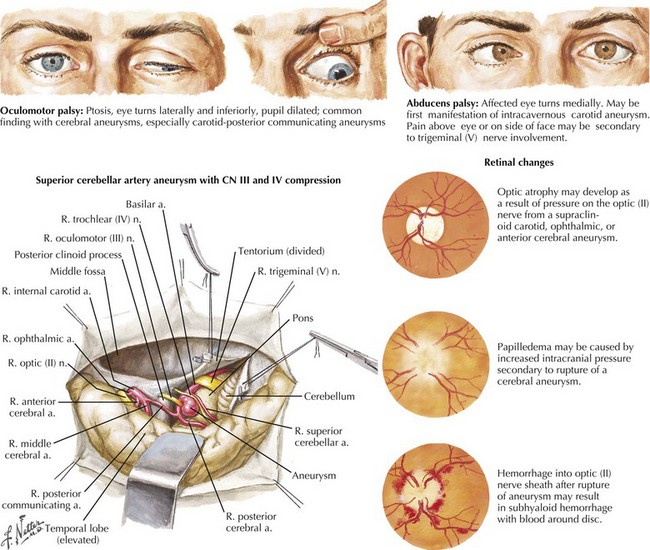 cranial nerves for pupil measurement