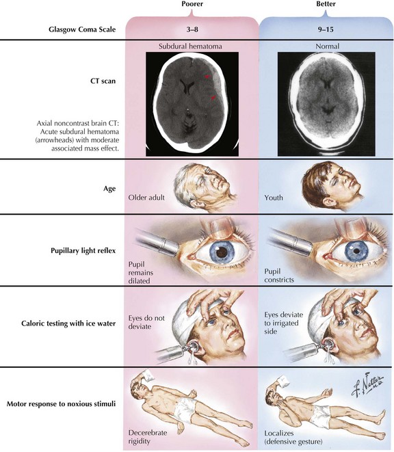 Coma Vegetative State Brain Death And Increased Intracranial
