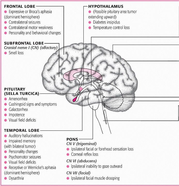 Neurologic emergencies and neurologic malignancies | Neupsy Key