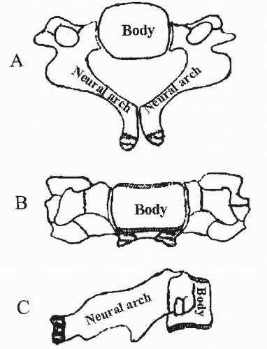 Evaluation of the Cervical Spine in Children | Neupsy Key