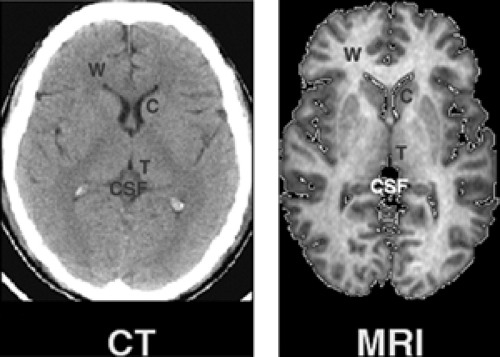 Neuroimaging Methods in the Study of Childhood Psychiatric Disorders ...