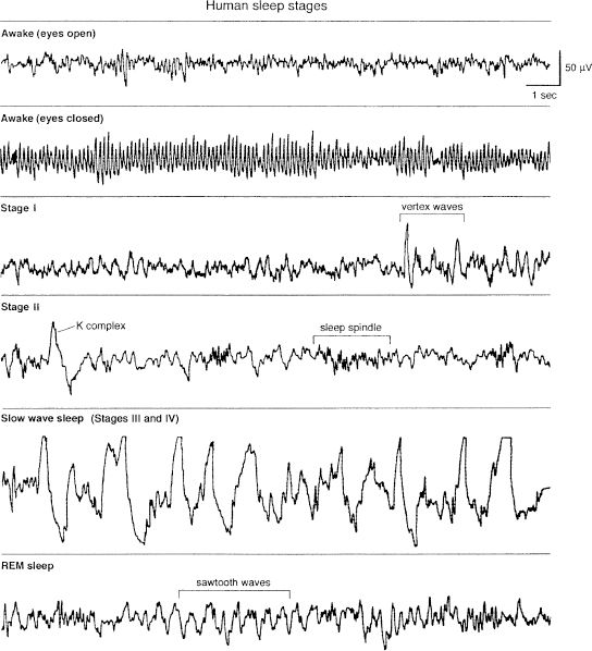 Normal Sleep and Sleep-Wake Disorders | Neupsy Key