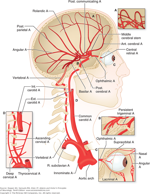 Chapter 34. Cerebrovascular Diseases | Neupsy Key