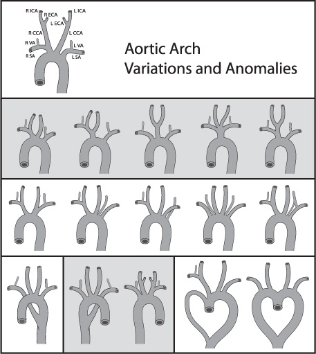 Cranial Vascular Anatomy Neupsy Key