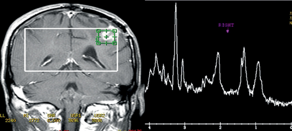 Neuroimaging | Neupsy Key