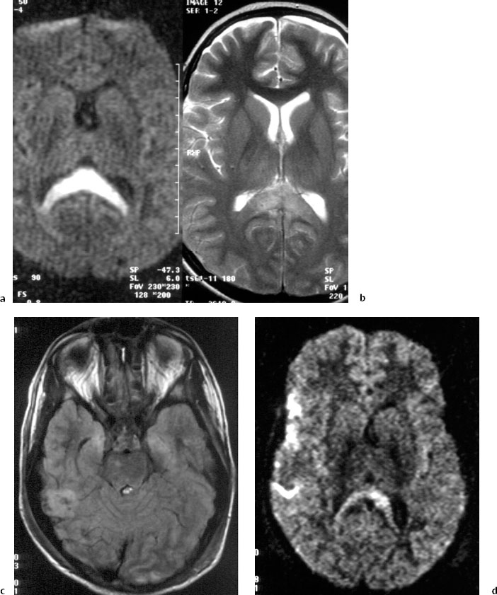 Fig.5.1