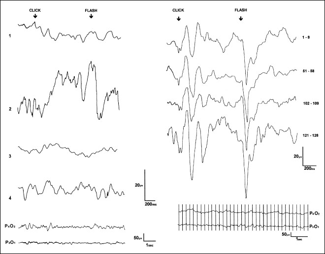 Fig.5.4