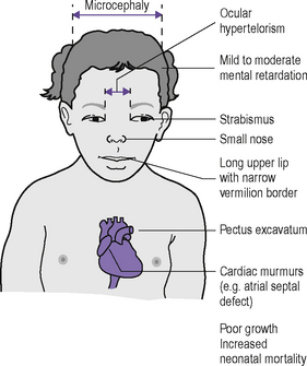 Psychoactive substance use disorders | Neupsy Key