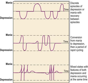 Epidemiology and aetiology of mood disorders | Neupsy Key