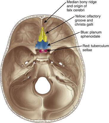 Surgical Management of Midline Anterior Skull Base Meningiomas | Neupsy Key