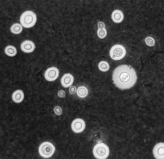 india ink cryptococcus neoformans