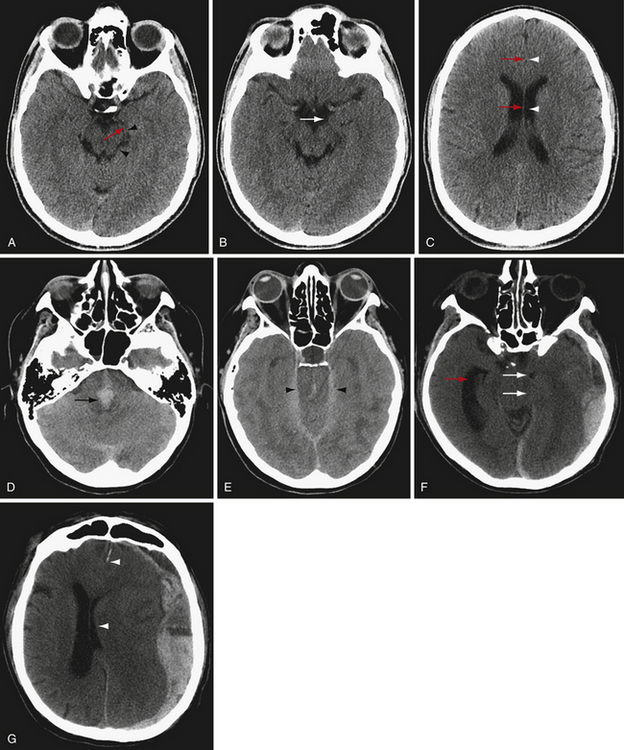 Principles of Modern Neuroimaging | Neupsy Key