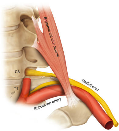 M scalenus anterior