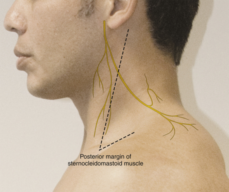 Accessory Nerve