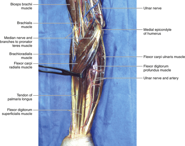 Interfascicular Anatomy of the Motor Branch of the Ulnar Nerve: A Cadaveric  Study - ScienceDirect