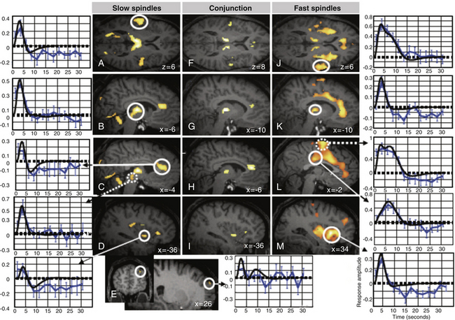 Neuroimaging Techniques | Neupsy Key