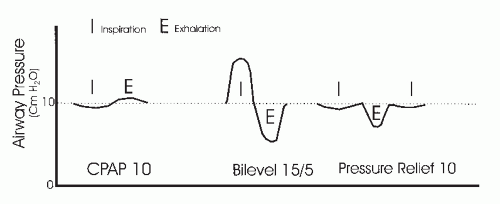 Positive Airway Pressure Treatment for Sleep Apnea | Neupsy Key