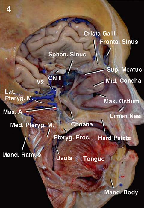 nasal choanae