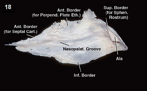 Anatomy of the Nasal Cavity and Paranasal Sinuses | Neupsy Key