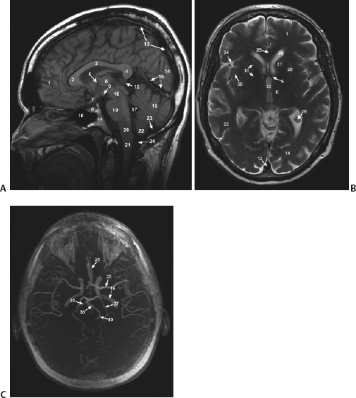 Basics Of Neuroimaging | Neupsy Key