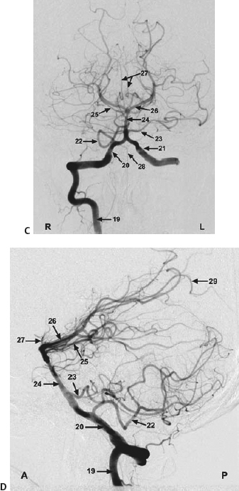 Basics Of Neuroimaging | Neupsy Key