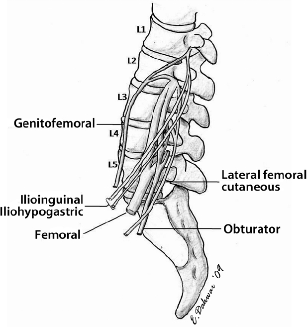 Minimally Invasive Lateral Retroperitoneal Trans-Psoas Interbody Fusion ...