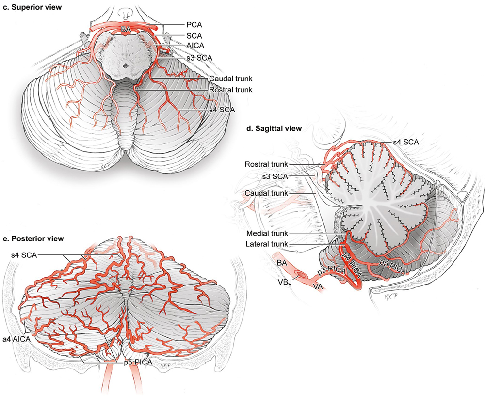 cerebellar vermis sagittal view