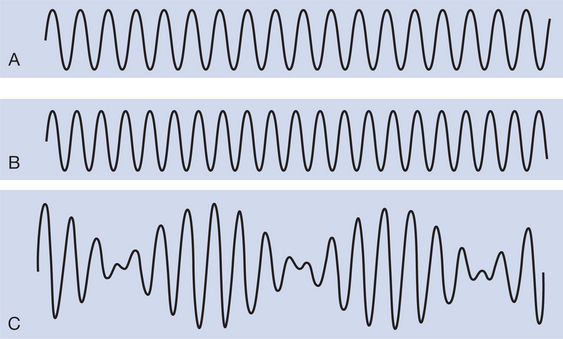 What Is Interferential Current – Everything You Need To Know