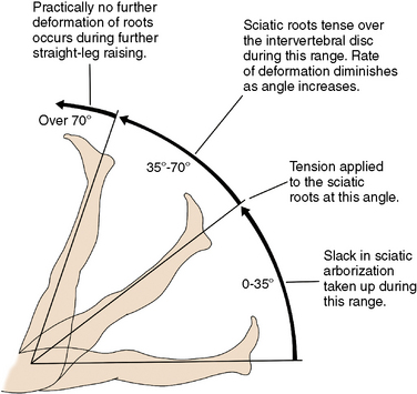 sciatica leg test