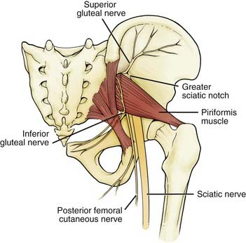 inferior gluteal nerve injury