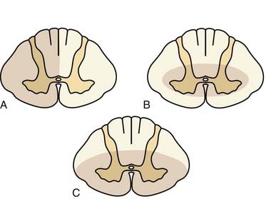 Assessment Of The Cervical Spine After Trauma 