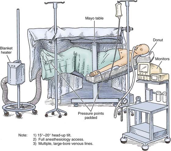 Surgical Management Of Traumatic Brain Injury 