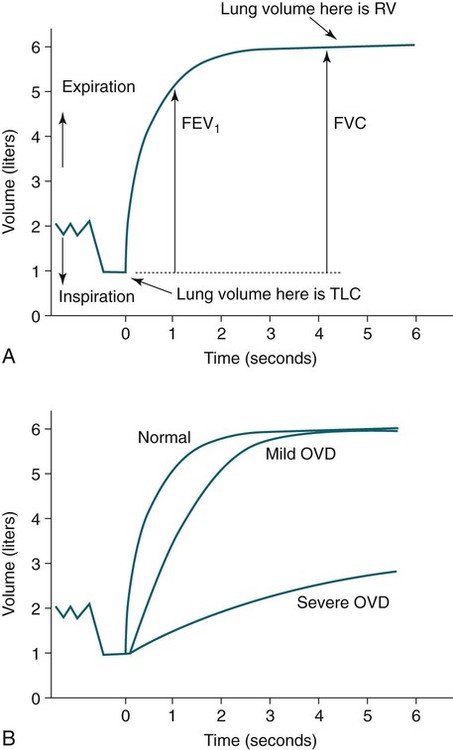 Sleep and Obstructive Lung Disease | Neupsy Key