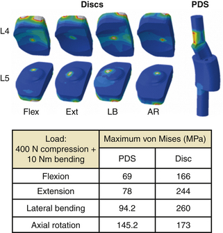 Biomechanical Testing | Neupsy Key