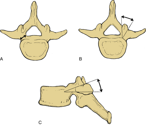 Dorsal Thoracic And Lumbar Screw Fixation And Pedicle Fixation Techniques Neupsy Key