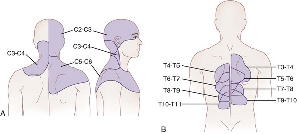 Feminizing facets of the female arm and back: tricipital (1