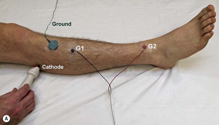 nerve-conduction-test-on-neck-bdadeveloper