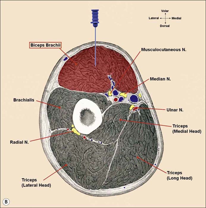 Anatomy for Needle Electromyography | Neupsy Key