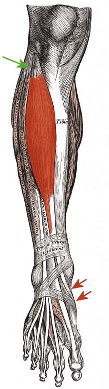 Peroneal Neuropathy | Neupsy Key