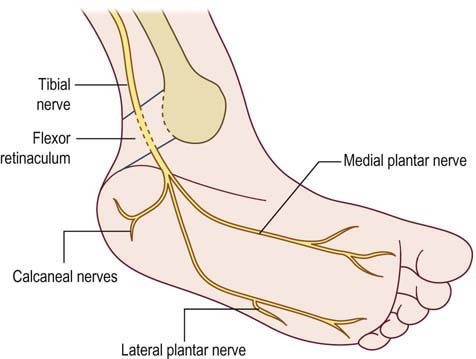 pain in medial plantar nerve