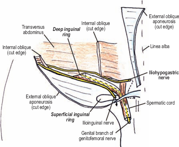 3. Anatomy of the Inguinal Canal - Inguinal Hernias
