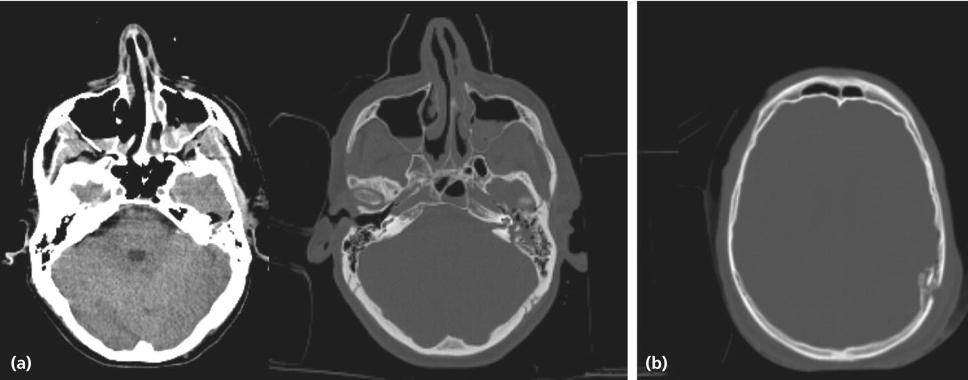 c2-fig-0004