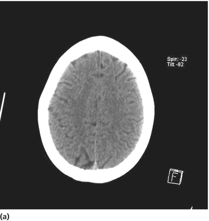 c12-fig-0002