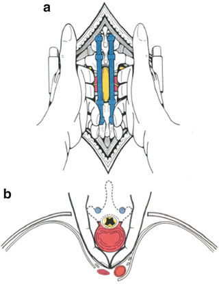 A11926_3_En_53_Fig8_HTML.gif