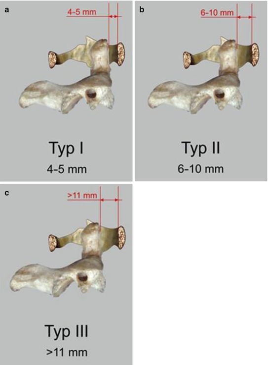 A302505_1_En_12_Fig4_HTML.jpg