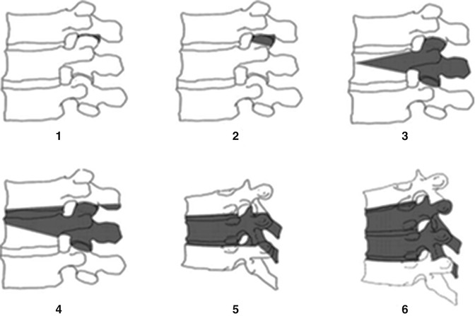 Clinical and Radiographic Evaluation | Neupsy Key