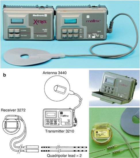 A312377_1_En_5_Fig2_HTML.jpg