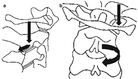 Functional Anatomy And Biomechanics Of The Cervical Spine Neupsy Key