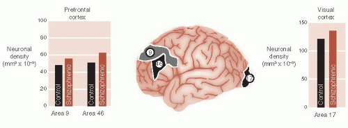 Schizophrenia | Neupsy Key