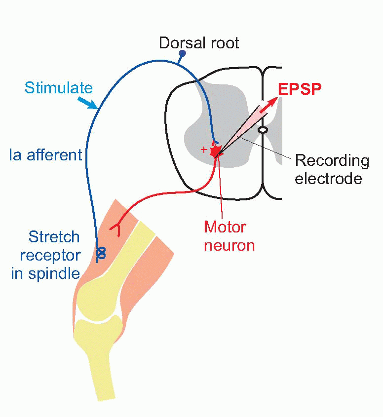 postsynaptic dorsal column stimulation